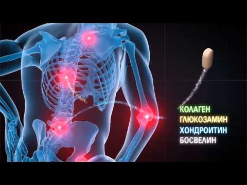 Видео о препарате Артростоп Рапид плюс Метилсульфонилметан N180