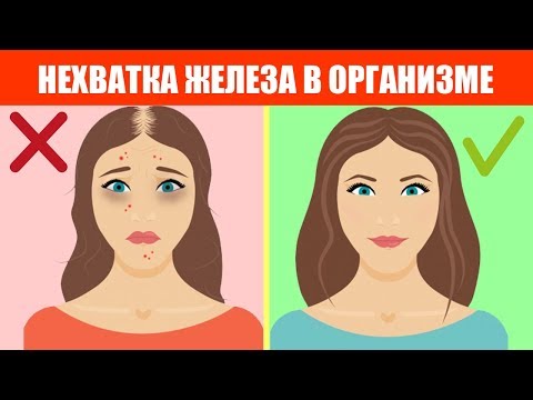 Видео о препарате Ферликсит (Ferlixit) 62,5мг 5мл №5